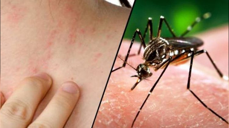 Zika: Tanda-tanda dan Pencegahan dari PAFI Jakarta